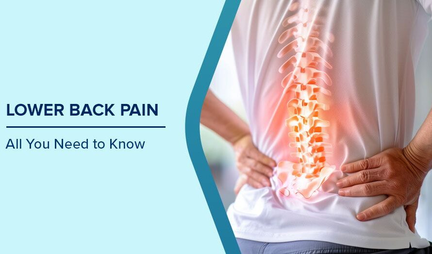 Bone Weakness in Pakistan A Growing Public Health Challenge