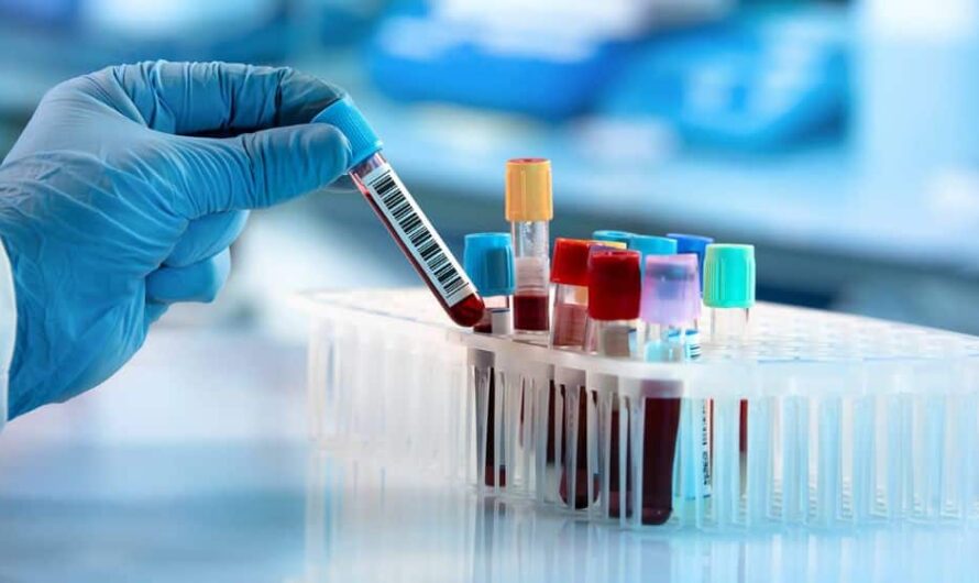 Sindh Fixes New Rates: 4 Major Reductions in Dengue, Malaria, and CBC Test Costs