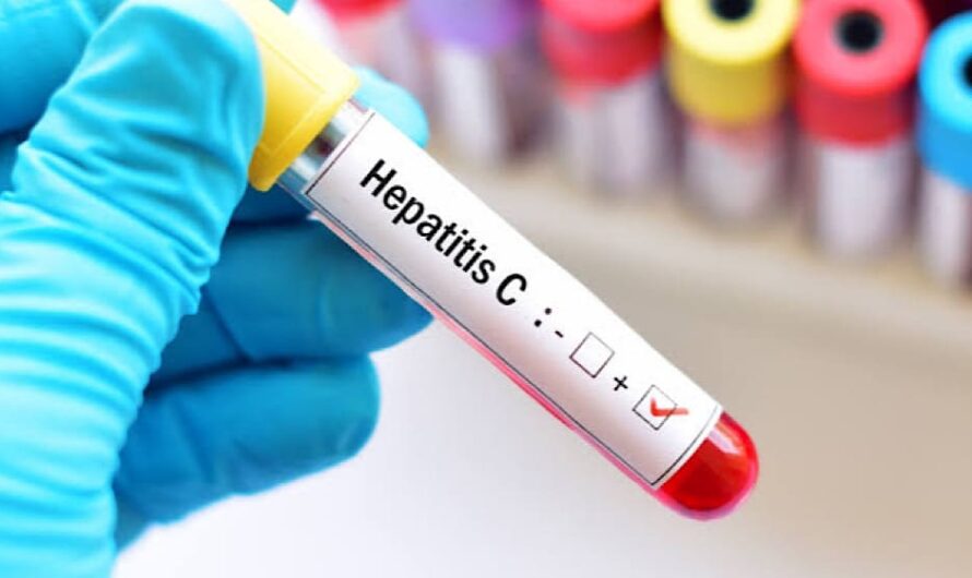 Pakistan Receives Hepatitis C Medicines from Egypt to Boost Health Programs